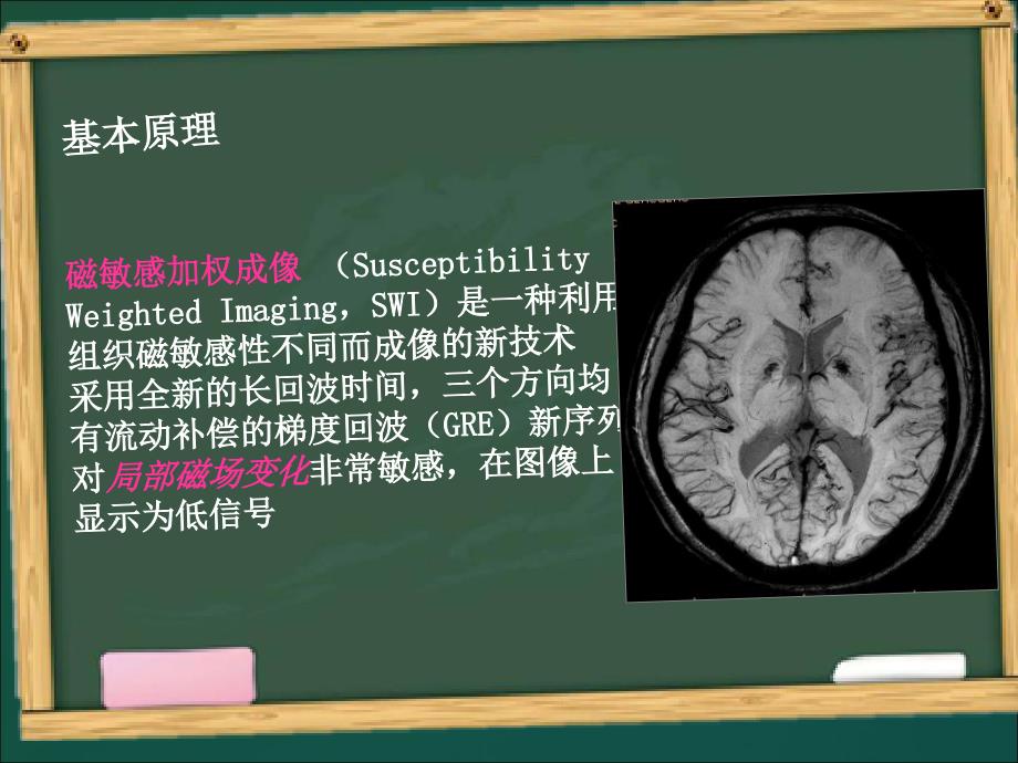 磁敏感效应在脑部的应用课件_第4页