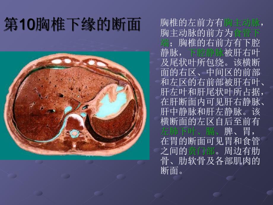 临床腹部ct阅片基础课件_第4页