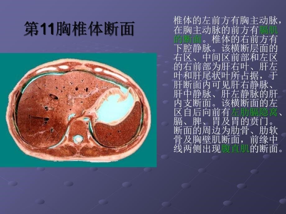 临床腹部ct阅片基础课件_第5页