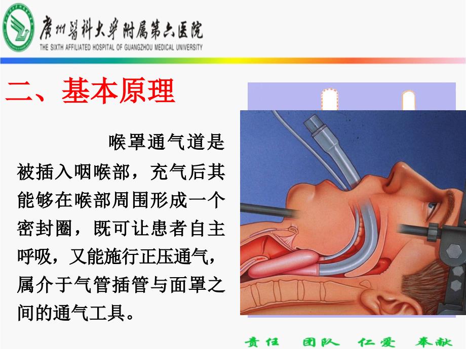 喉罩使用方法PPT课件_第4页