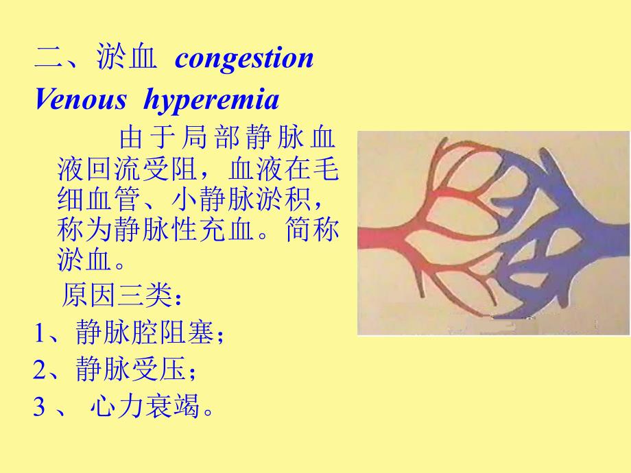 病理学第二章局部血液循环障碍_第4页