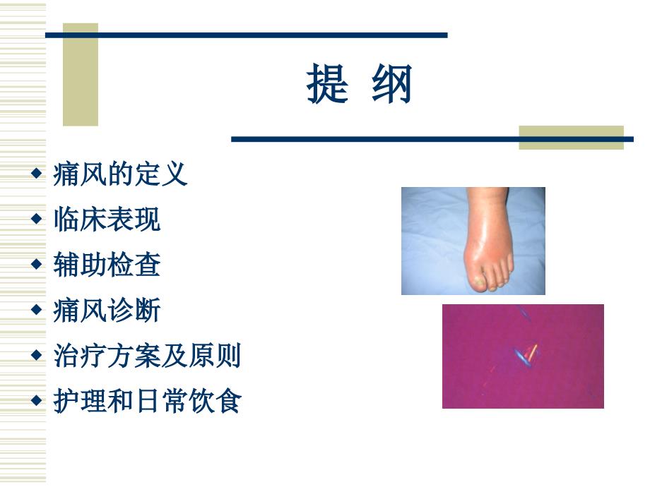 痛风病人的护理.ppt_第2页