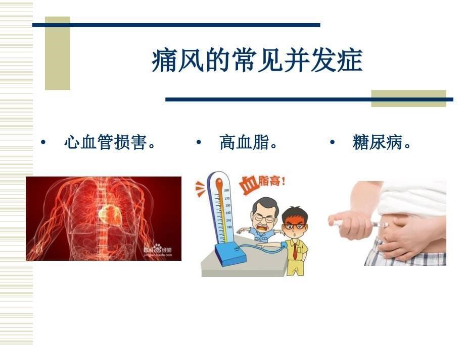 痛风病人的护理.ppt_第5页