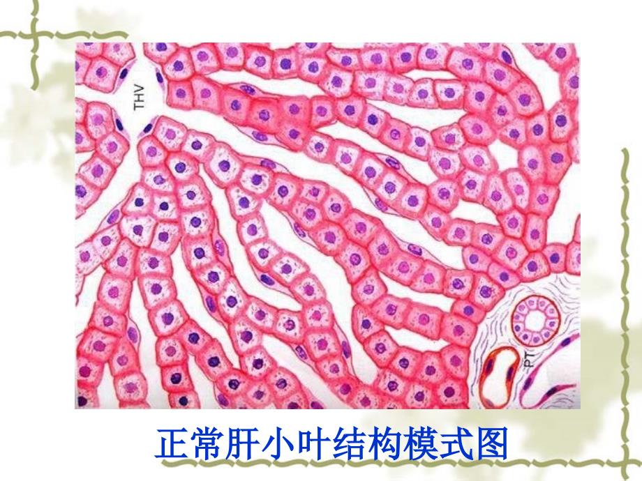 最新病理学消化腺疾病浙大城院PPT文档_第2页