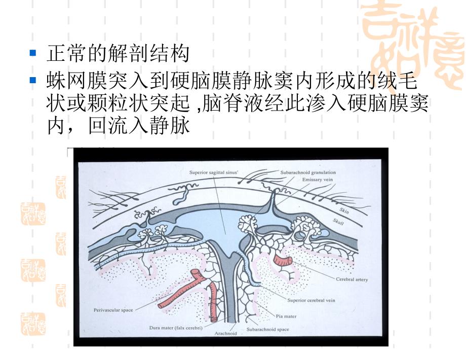 蛛网膜颗粒的影像学表现_第2页