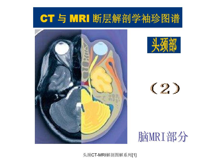 头颈CTMRI解剖图解系列1课件_第2页