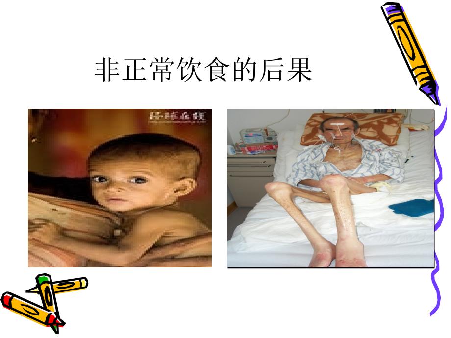 说说医院患者的饮食.ppt_第4页