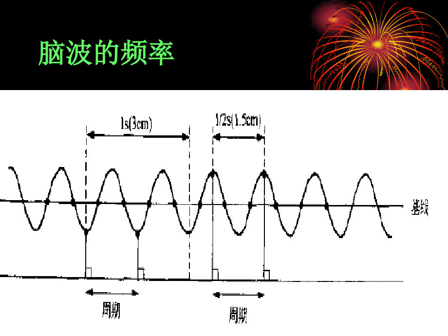 脑电图判读课件_第3页