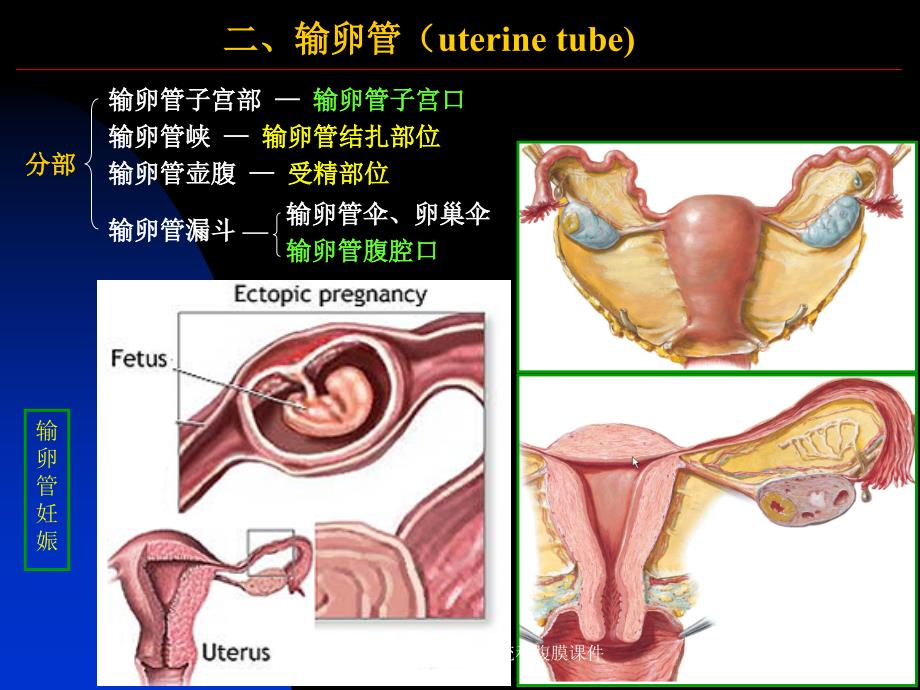 女性系统和腹膜课件_第3页