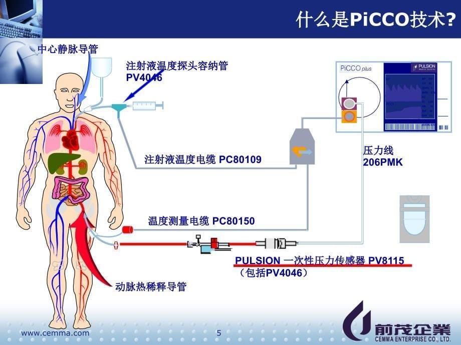 iCCO临床价值以及护理演示PPT_第5页