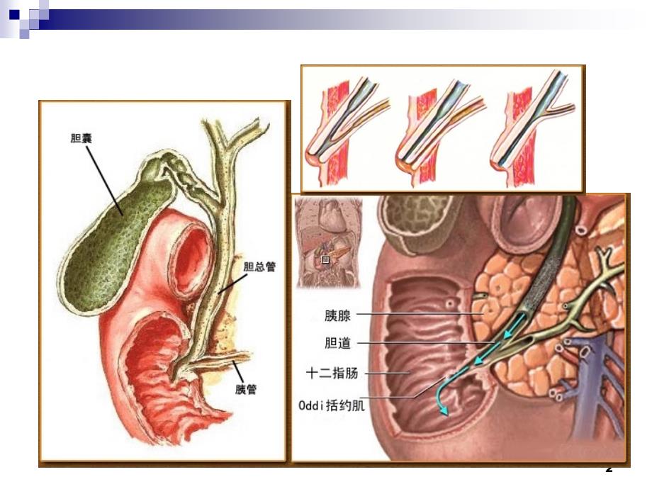 内科学教学课件：Acute Pancreatitis_第2页