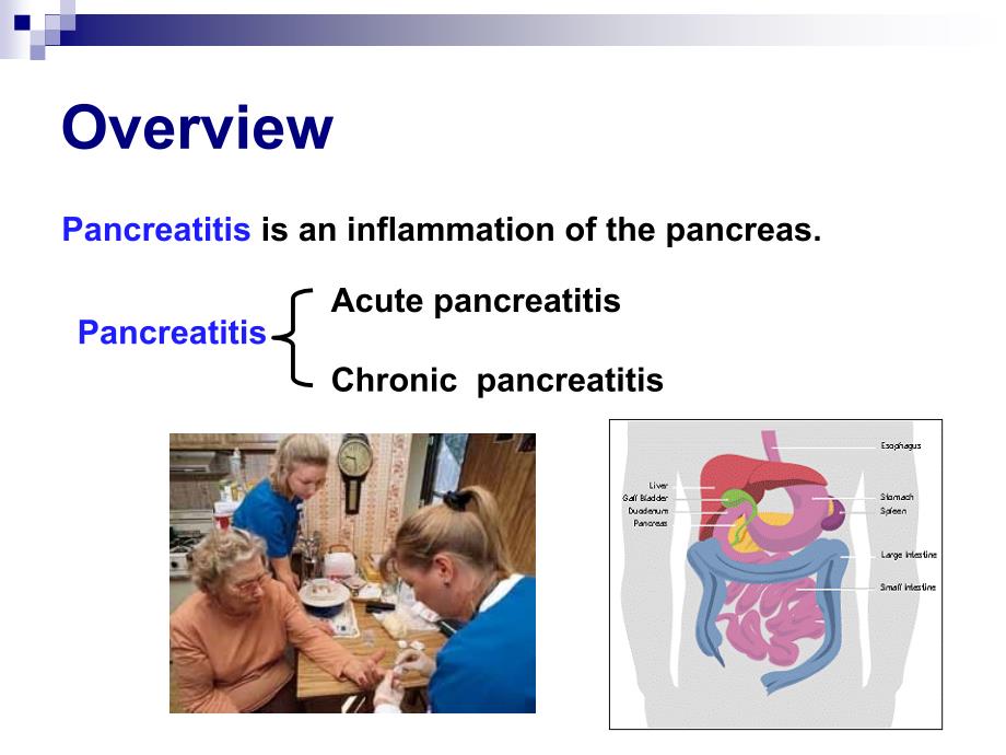 内科学教学课件：Acute Pancreatitis_第4页