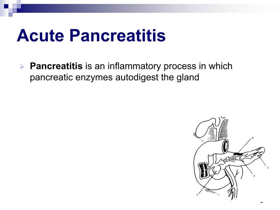 内科学教学课件：Acute Pancreatitis_第5页