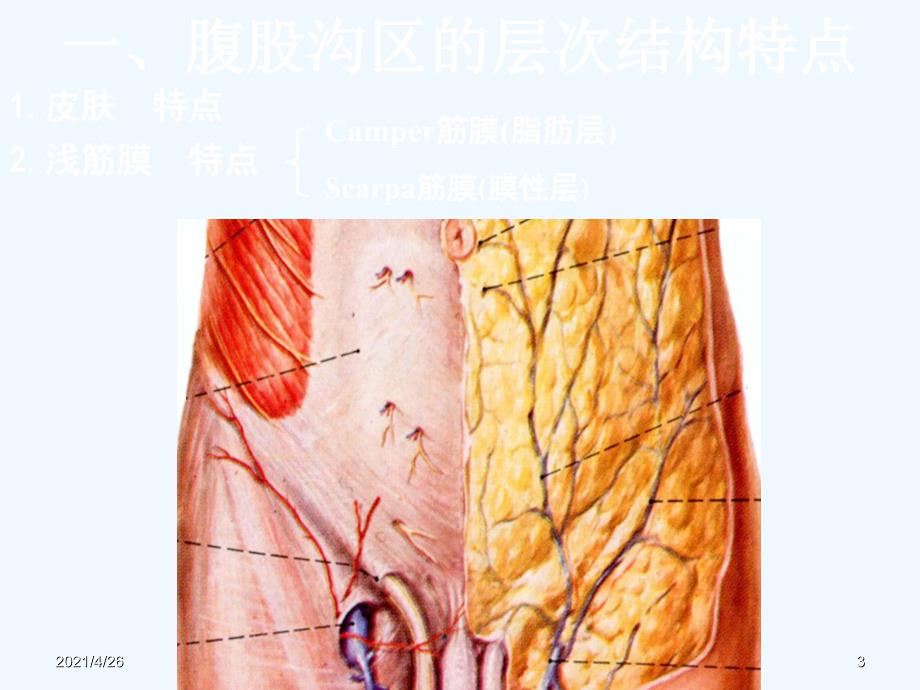 髂腹股沟区解剖精品课件_第3页