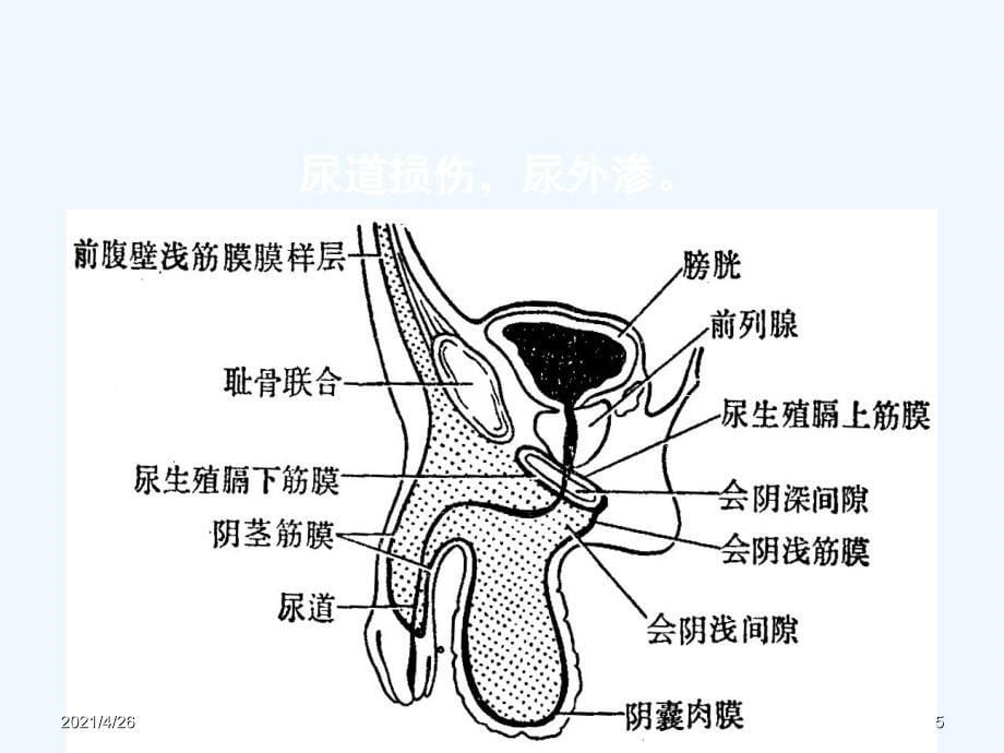 髂腹股沟区解剖精品课件_第5页