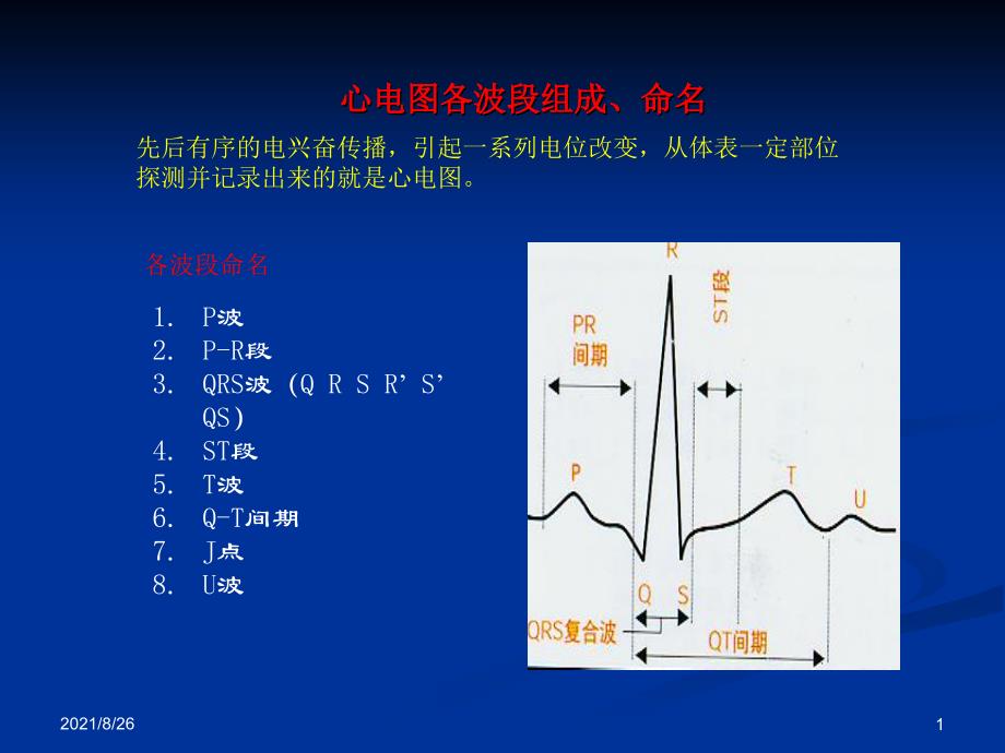 各种心电图表现课件PPT_第1页