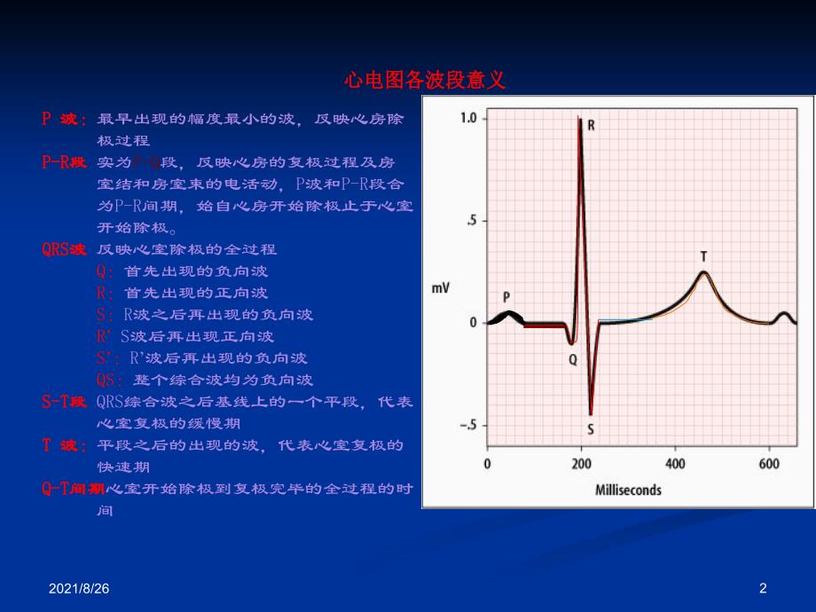 各种心电图表现课件PPT_第2页