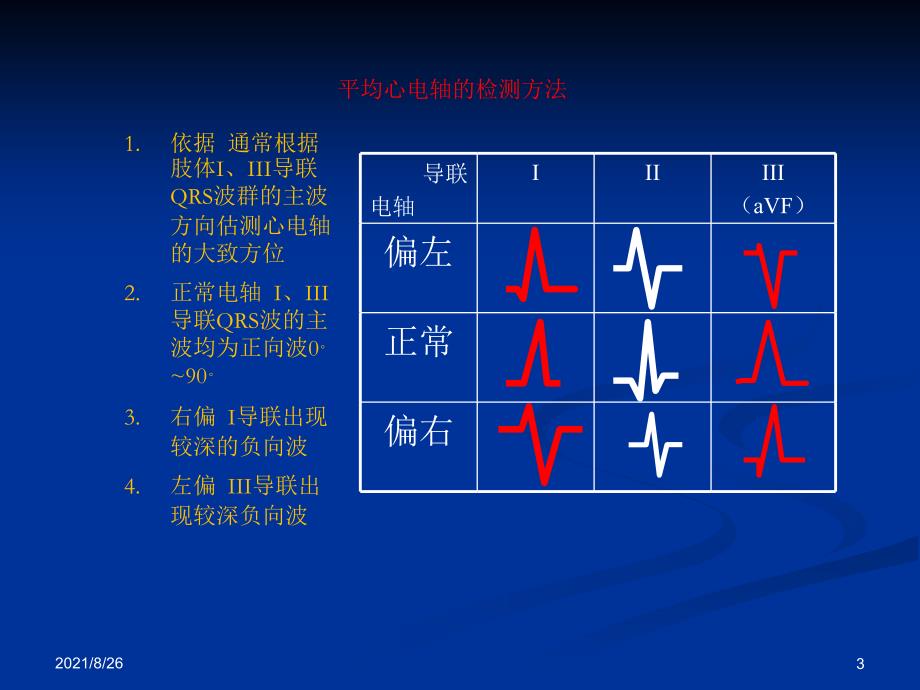 各种心电图表现课件PPT_第3页