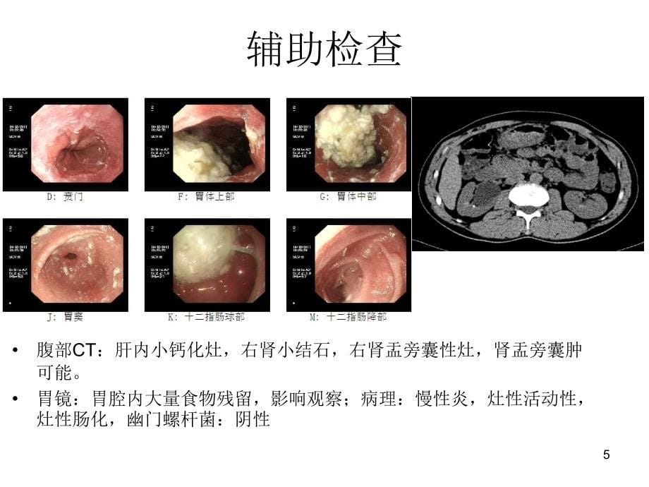 嗜酸细胞胃肠炎病例PPT课件_第5页