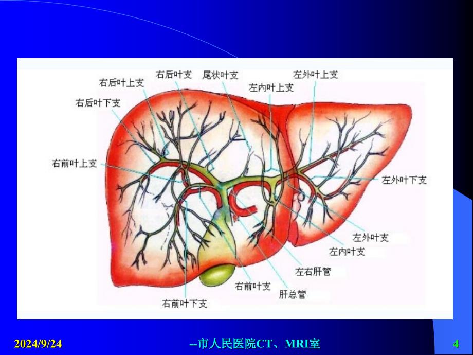 MRI胆道梗阻的应用课件_第4页