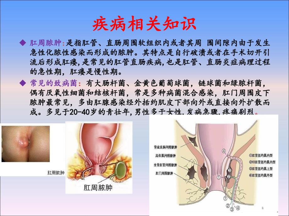 肛周脓肿护理查房课件_第4页