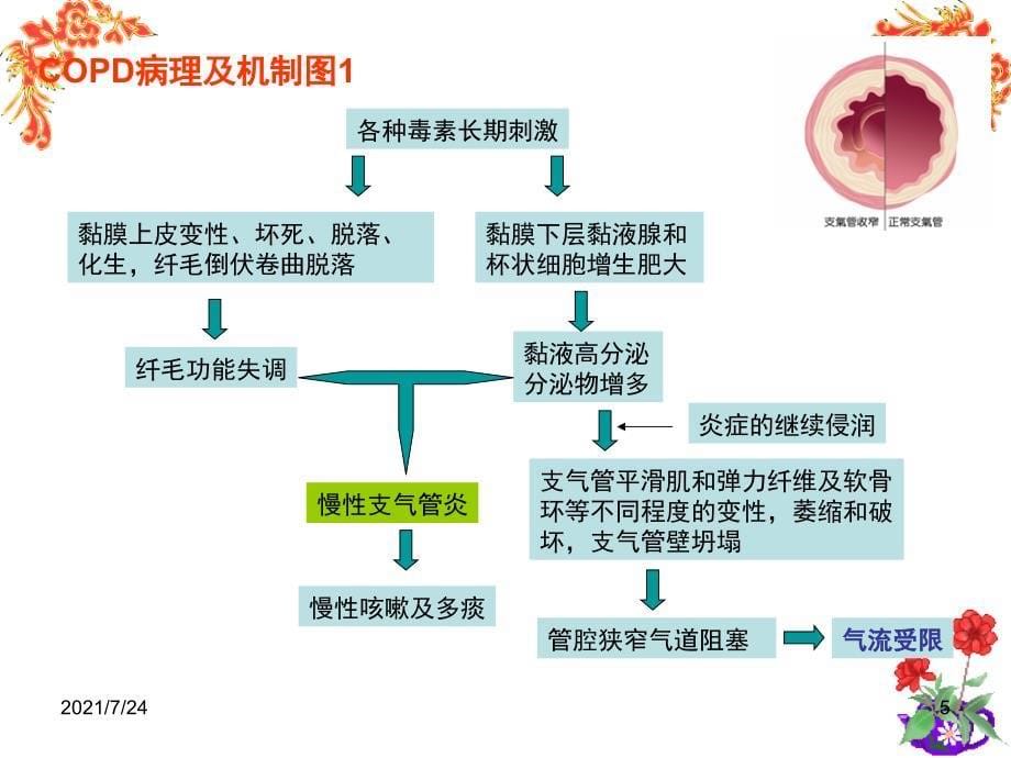 COPD护理进展PPT课件_第5页