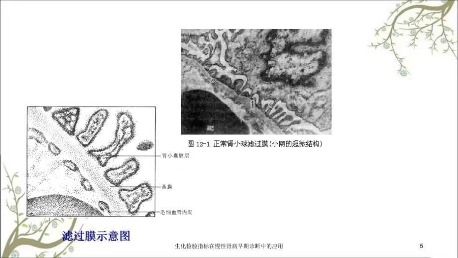 生化检验指标在慢性肾病早期诊断中的应用_第5页