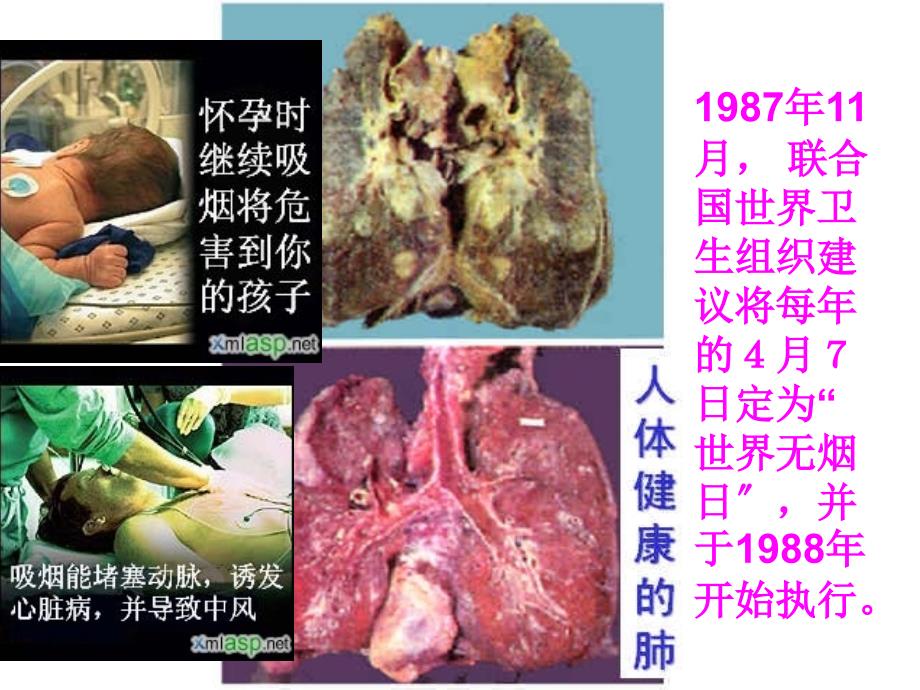 yong细胞的癌变_第2页