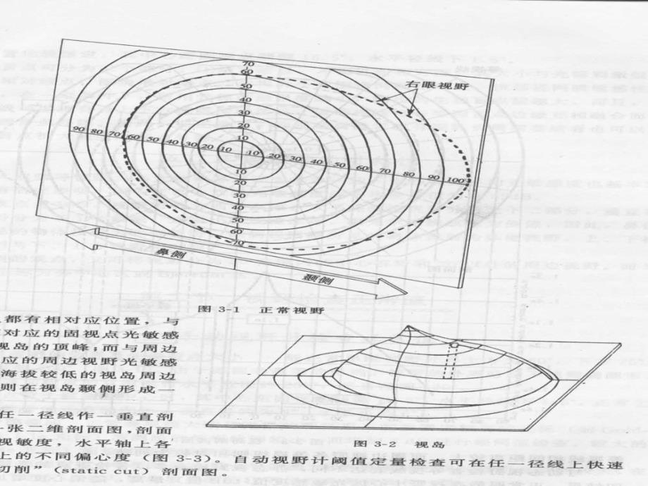 视野学眼科临床视野检测_第4页