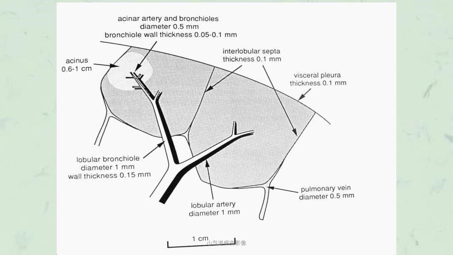小气道病变影像课件_第5页