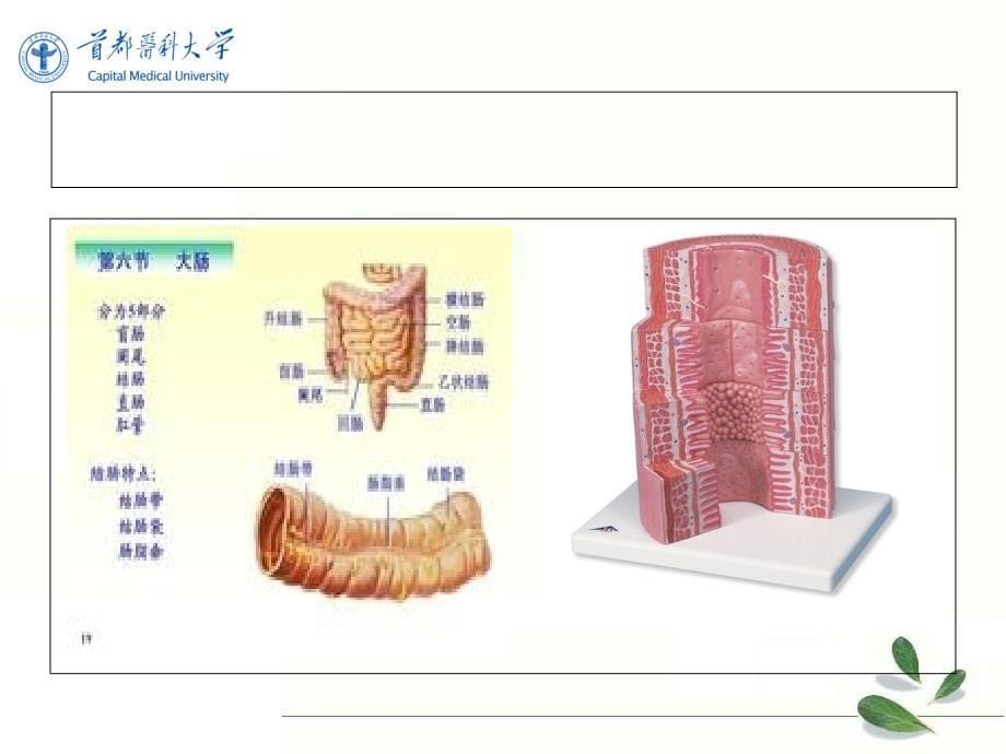 内科医学课件：溃疡性结肠炎_第5页