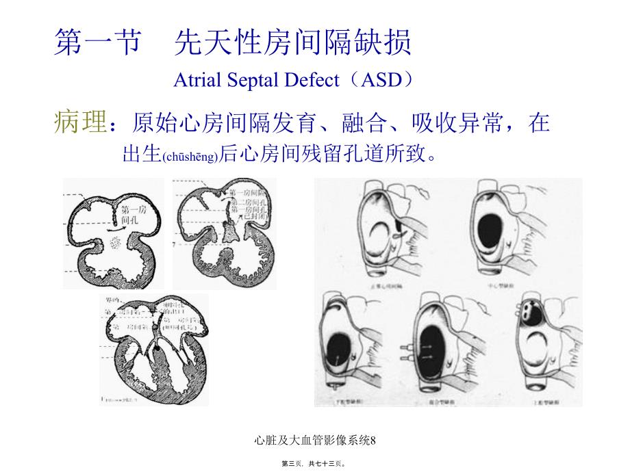 心脏及大血管影像系统8课件_第3页