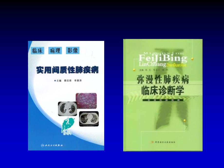 内科学教学课件：间质性肺病_第2页