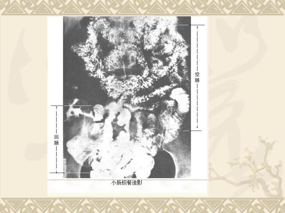 医学影像学第七版肠道系统_第2页