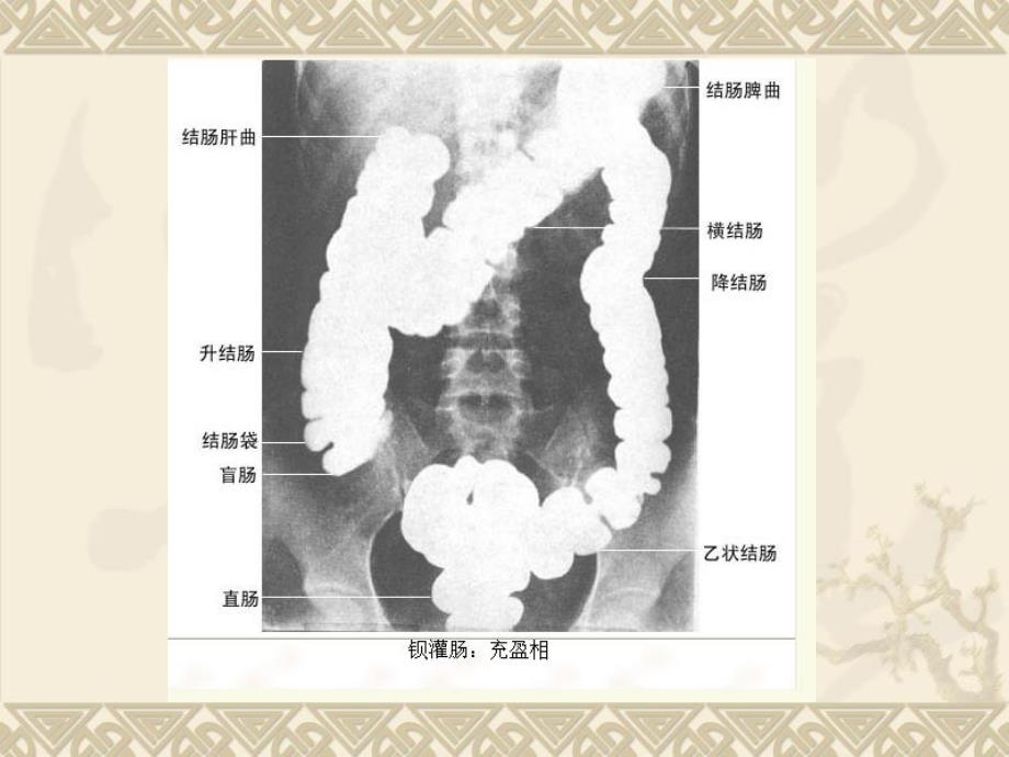 医学影像学第七版肠道系统_第3页