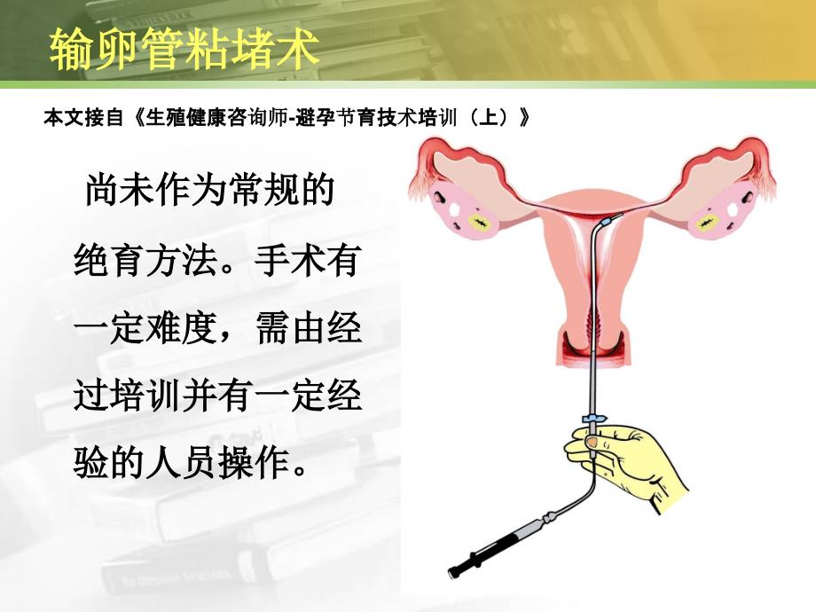 生殖健咨询师避孕节育技术培训下_第1页