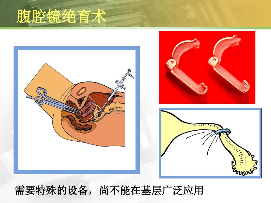 生殖健咨询师避孕节育技术培训下_第2页