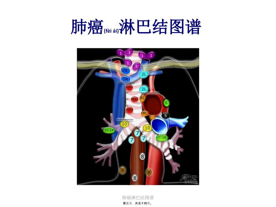 肺癌淋巴结图谱课件_第3页