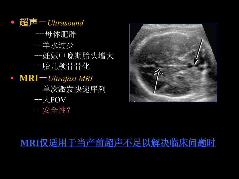 胎儿磁共振成像胎儿头颅MRI检查_第2页