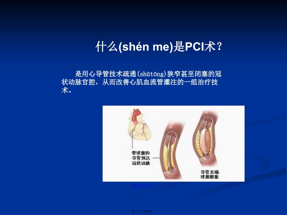 pci术前术后的护理学习教案_第2页