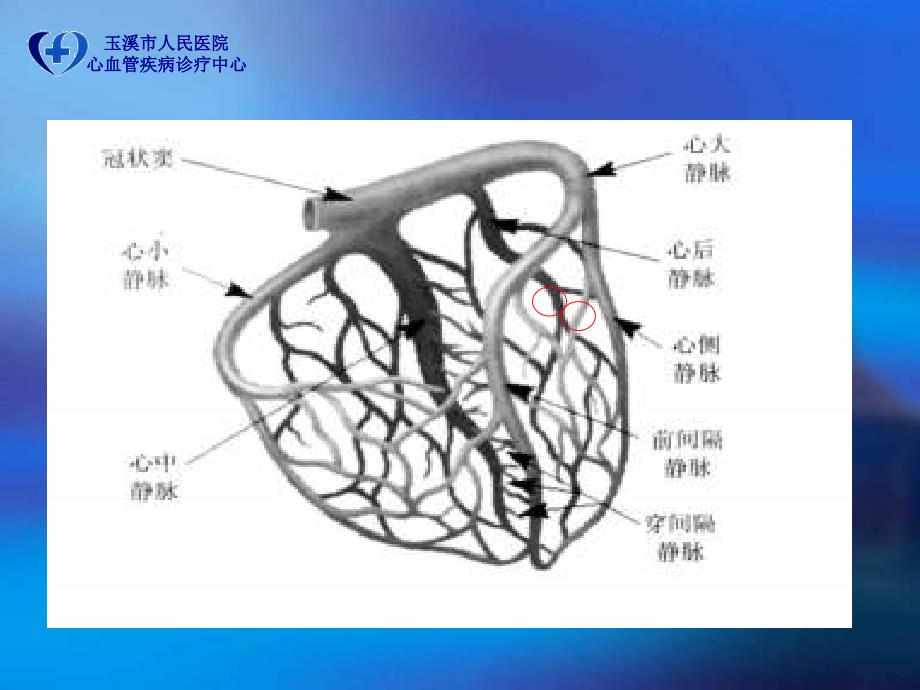 左室电极植入时不同投射角度的应用_第4页