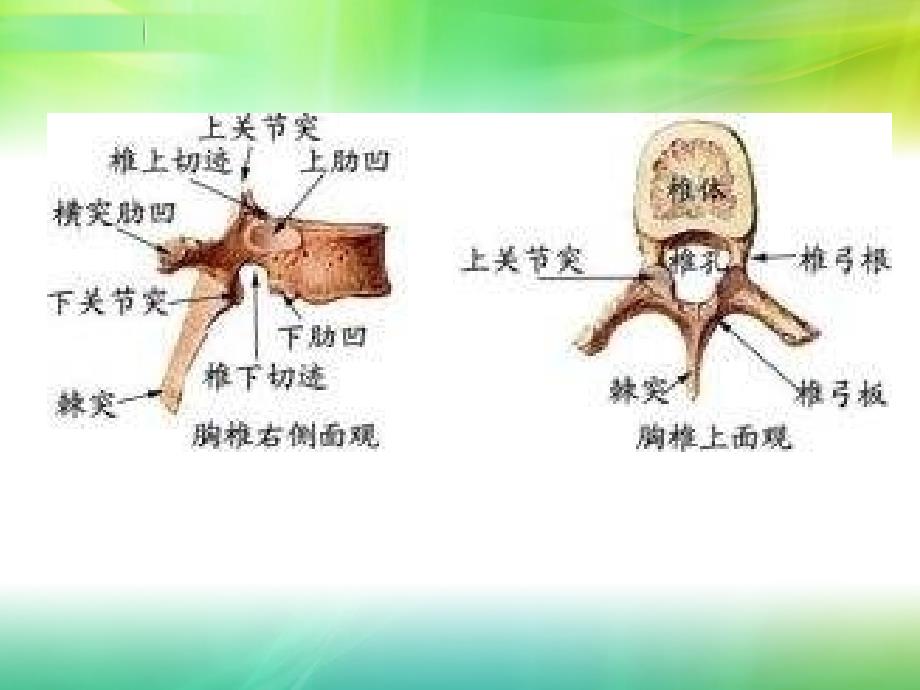 胸椎骨折的护理查房_第4页