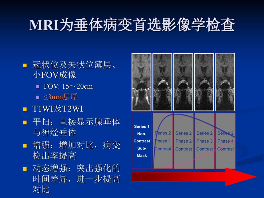 鞍区病变影像诊断.ppt_第2页