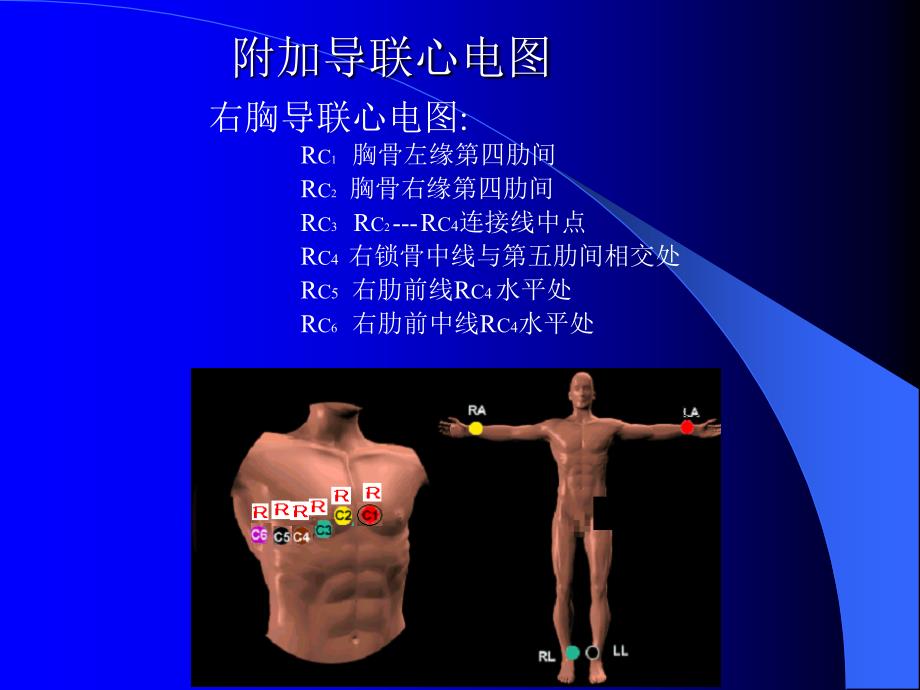 心电图幻灯实习讲课课件_第3页