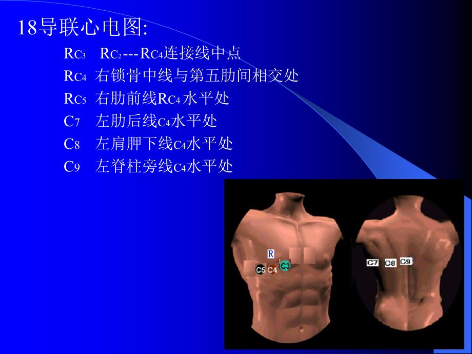 心电图幻灯实习讲课课件_第4页