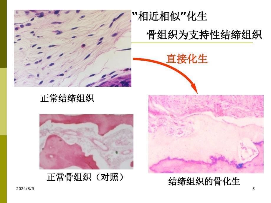 最新：病理学(四)文档资料_第5页