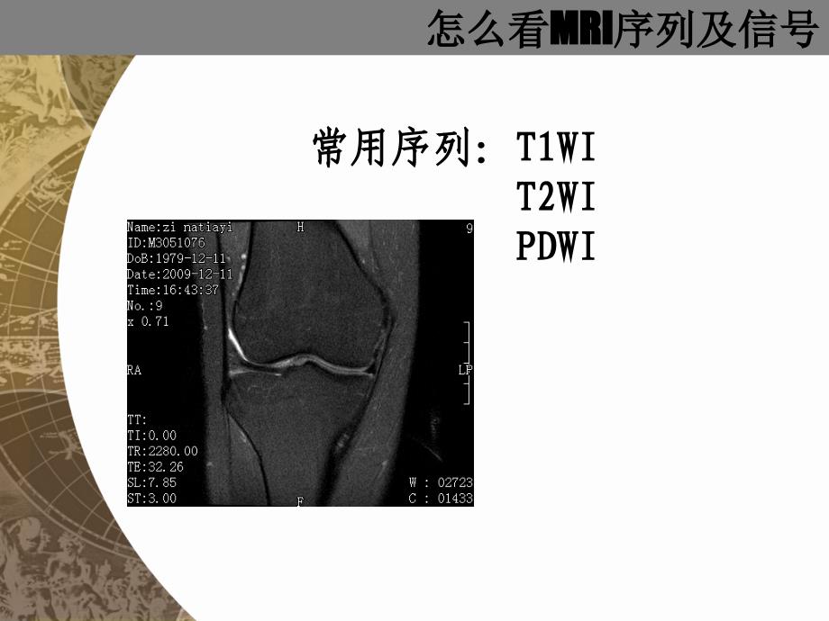 医院培训课件：怎么看MRI片_第3页