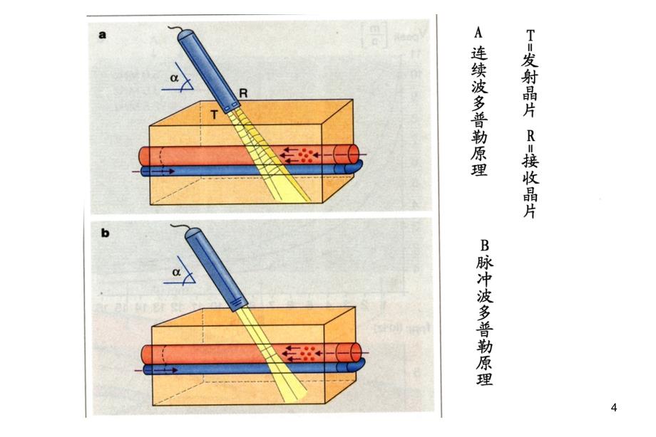 彩色多普勒技术最新课件_第4页