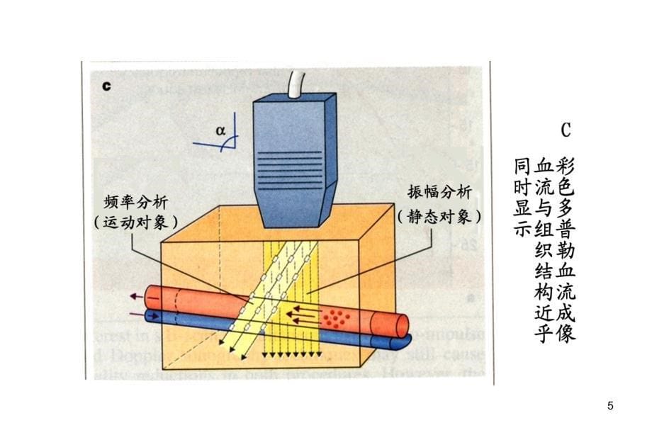 彩色多普勒技术最新课件_第5页