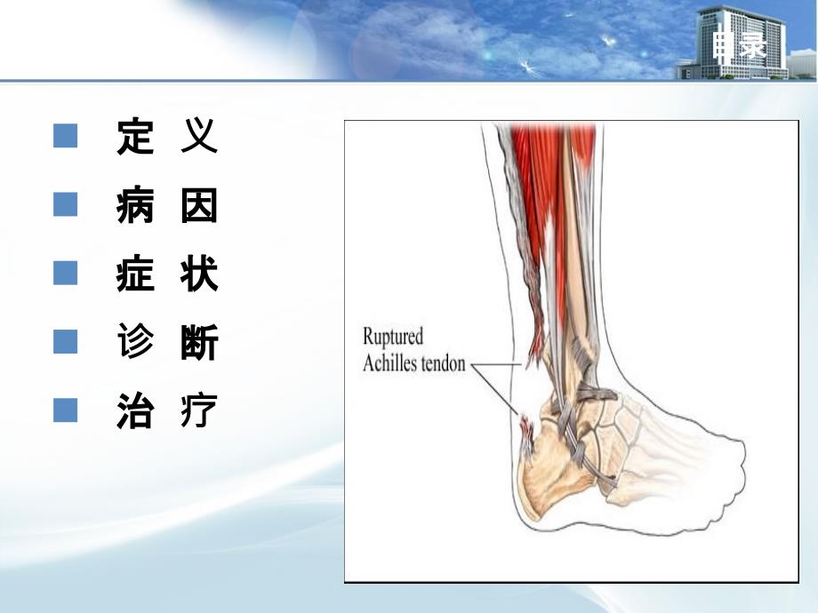 陈旧性跟腱断裂_第3页